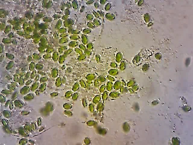 Algae under the microscope; Gardener took this photo of our algae showing that they are free swimming oval shaped single cells but will self-assemble into large cohesive clumps.